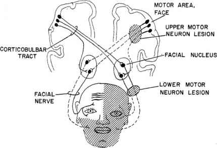 Cranial Nerve Face Drawing Pic