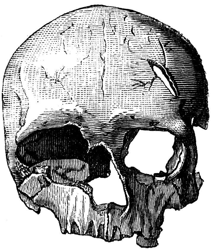 Medieval Skull Drawing Pic